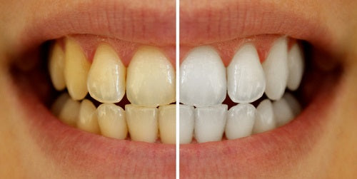 Obsessive™ V34 Pasta Dental Blanqueadora 50ml + Envío Gratis