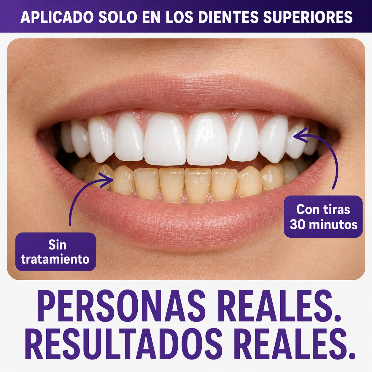 LumaWhite™ | 14 Tiras para una Sonrisa Más Blanca y Segura