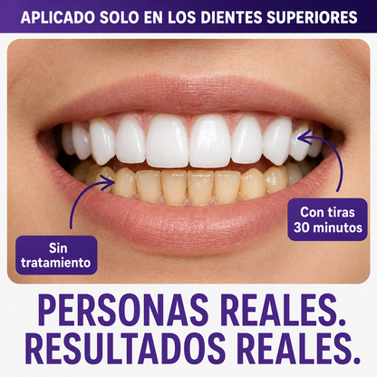 LumaWhite™ | 14 Tiras para una Sonrisa Más Blanca y Segura