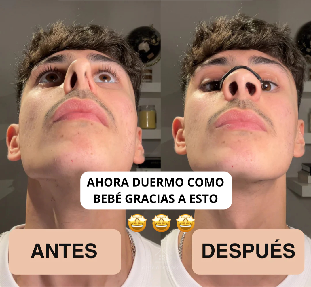 2x1 AirMax™ Nasal Pro Banda Nasal + Envío Gratis